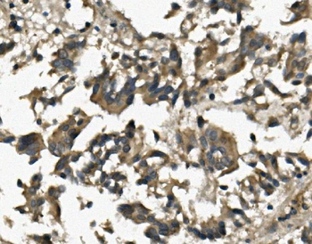 IL3RA/CD123 Rabbit Polyclonal Antibody