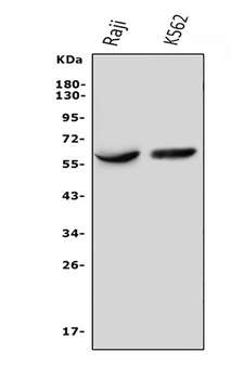 IL3RA/CD123 Rabbit Polyclonal Antibody