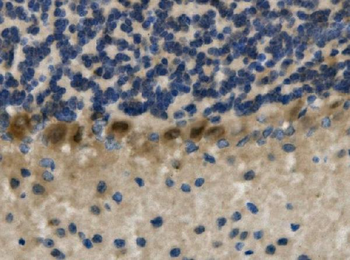 LIM1/LHX1 Rabbit Polyclonal Antibody
