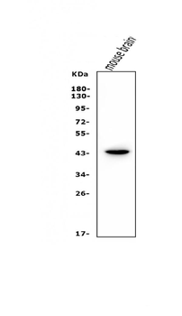 LIM1/LHX1 Rabbit Polyclonal Antibody