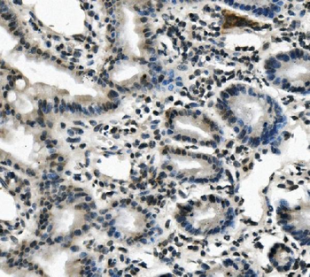 Lin28/LIN28A Rabbit Polyclonal Antibody