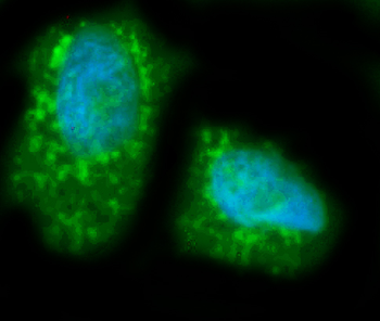 LIPC Rabbit Polyclonal Antibody
