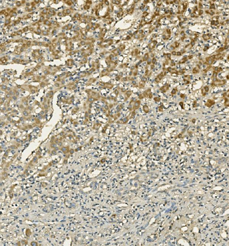 LIPC Rabbit Polyclonal Antibody