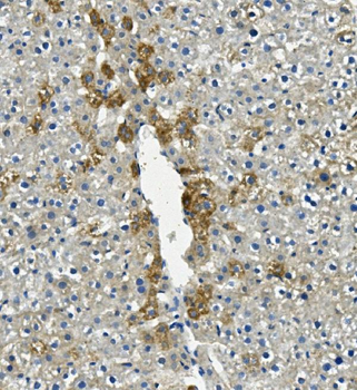 LIPC Rabbit Polyclonal Antibody
