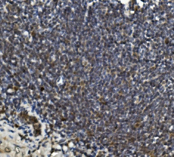 LRPPRC/GP130 Rabbit Polyclonal Antibody