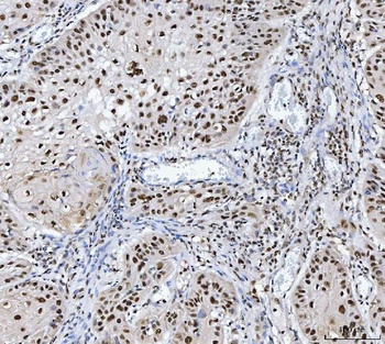 MBNL1 Antibody
