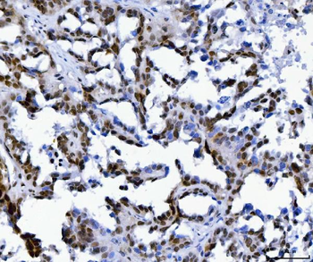MBNL1 Antibody