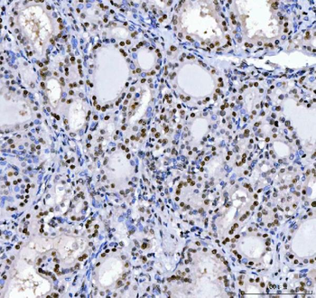 MBNL1 Antibody