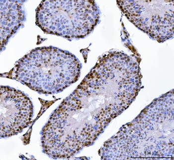 MBNL1 Antibody