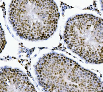 MBNL1 Antibody
