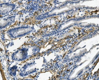 CD146/Mcam Rabbit Polyclonal Antibody