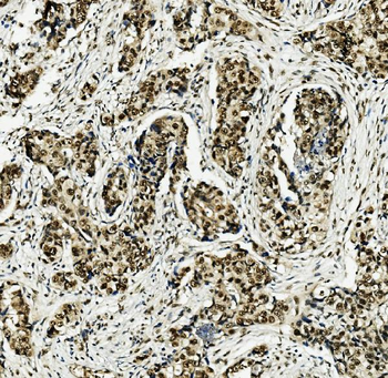 MCM5 Rabbit Polyclonal Antibody