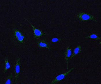 ME2 Antibody