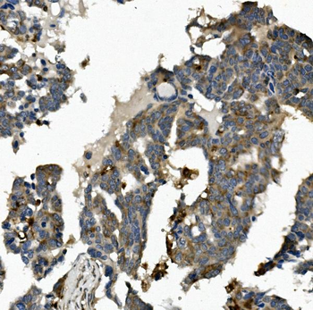 ME2 Antibody