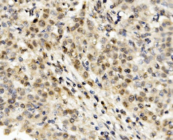 MNT Rabbit Polyclonal Antibody
