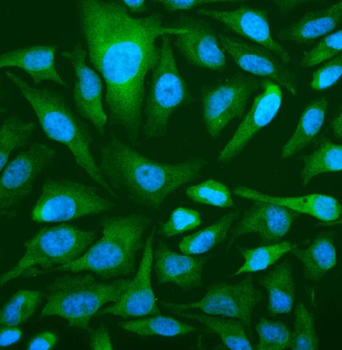 OAS3 Rabbit Polyclonal Antibody