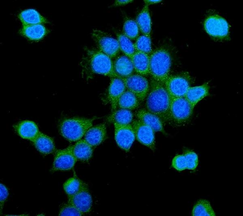 PCK2 Antibody
