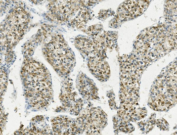 PCK2 Antibody