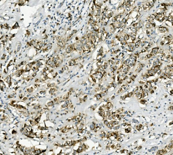 PCK2 Antibody