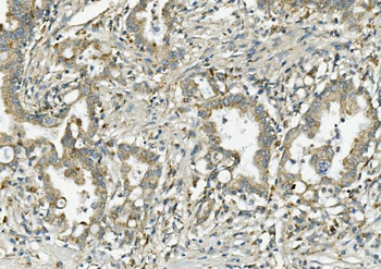 PCK2 Antibody