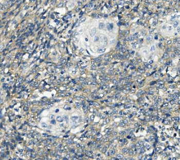 PHEX Antibody