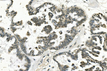 PHEX Antibody