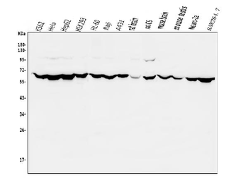 PIAS2 Antibody