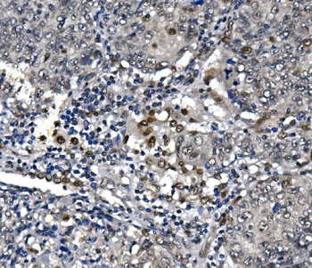 RNA polymerase II/POLR2A Rabbit Polyclonal Antibody