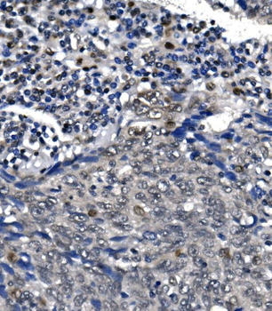 RNA polymerase II/POLR2A Rabbit Polyclonal Antibody
