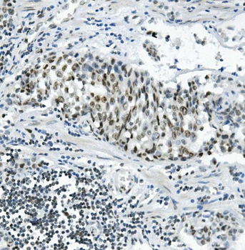 PRDM5 Antibody