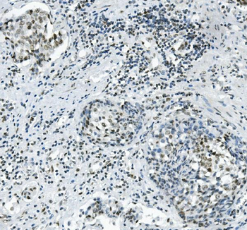 PRDM5 Antibody