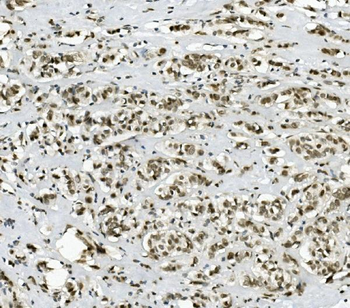 PRDM5 Antibody
