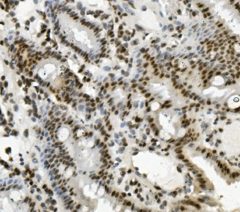 PRDM5 Antibody