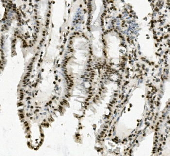 PRDM5 Antibody