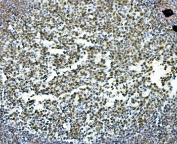 PRDM5 Antibody