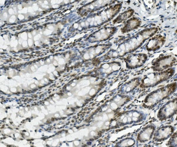 PRDM5 Antibody