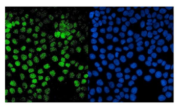 PTF1A Rabbit Polyclonal Antibody