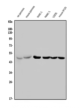 PTF1A Rabbit Polyclonal Antibody