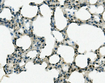 REC8 Rabbit Polyclonal Antibody