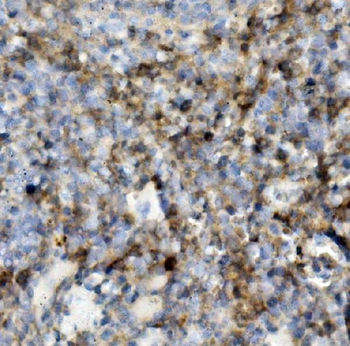 PSGL-1/Selplg/PSGL Rabbit Polyclonal Antibody