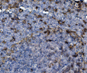 PSGL-1/Selplg/PSGL Rabbit Polyclonal Antibody