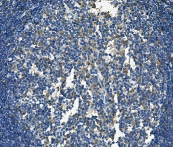 PSGL-1/Selplg/PSGL Rabbit Polyclonal Antibody