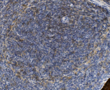PSGL-1/Selplg/PSGL Rabbit Polyclonal Antibody