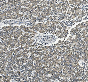 Vinexin/SORBS3 Antibody