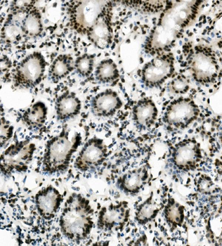 Vinexin/SORBS3 Antibody