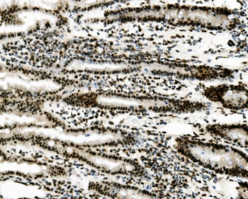 Vinexin/SORBS3 Antibody
