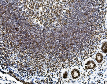 Vinexin/SORBS3 Antibody