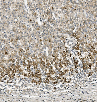 Sprouty 4/Spry-4/SPRY4 Rabbit Polyclonal Antibody