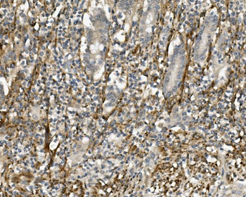 Sprouty 4/Spry-4/SPRY4 Rabbit Polyclonal Antibody