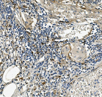 Sprouty 4/Spry-4/SPRY4 Rabbit Polyclonal Antibody
